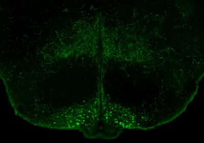 A cross-section of a mouse hypothalamus, where cells of the arcuate nucleus are shown in bright green at the bottom.